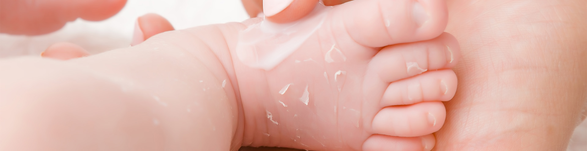 Baby hands and feet on sale peeling